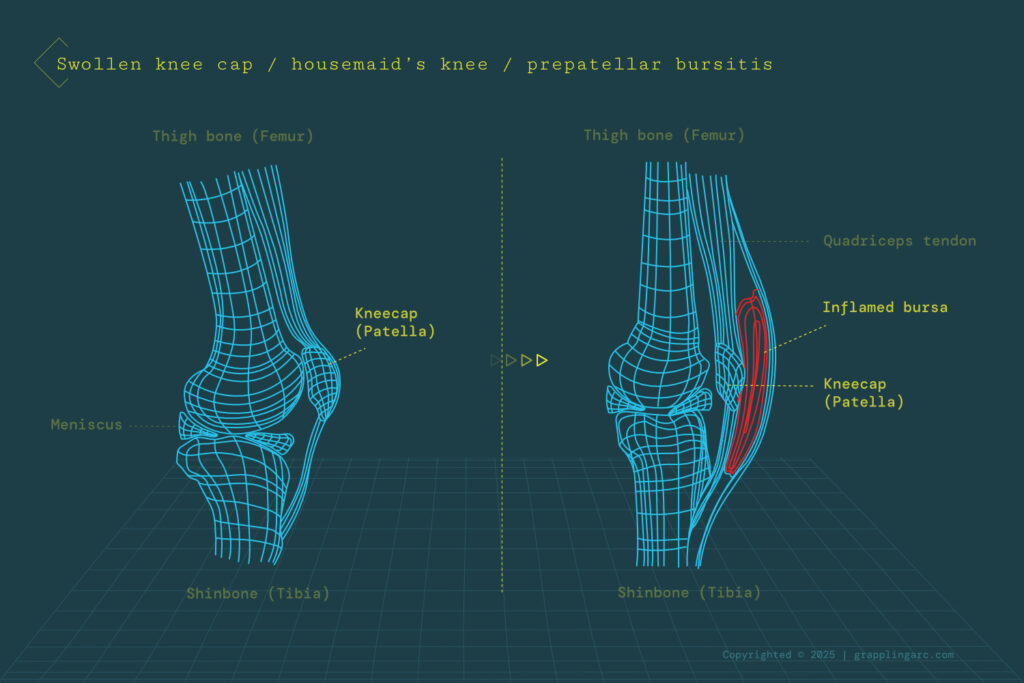 Most common injuries in grappling arts and contact sports public articles