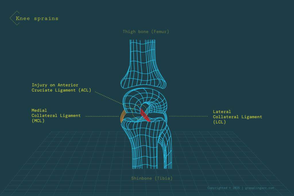 Most common injuries in grappling arts and contact sports public articles